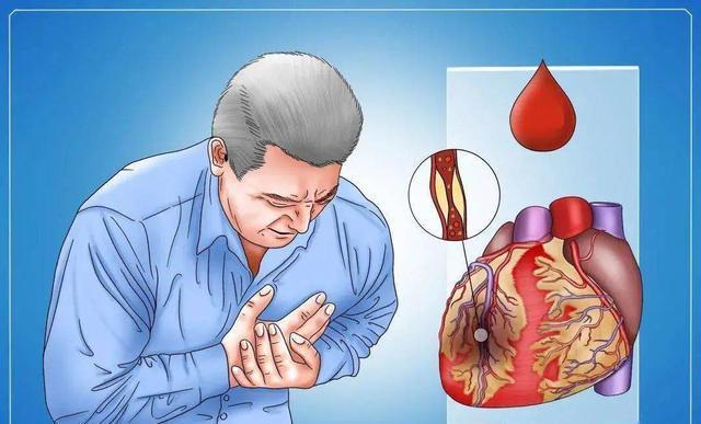 九游体育：医生提醒：超过70岁的老人宁可不运动坐着也别在3个时候运动(图3)